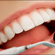 Illustration for article titled Healthy gums you really need